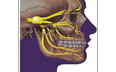 La névralgie faciale ( ou névralgie du trijumeau )
